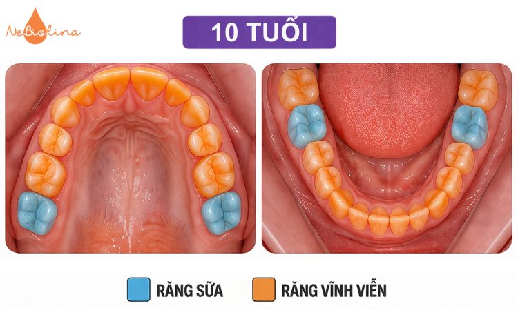 Răng vĩnh viễn dần hoàn thiện và ổn định khi bé 10 tuổi.