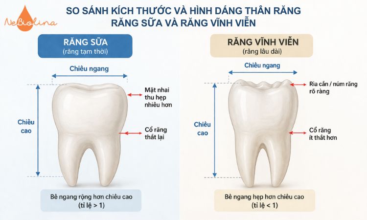 Sự khác biệt rõ rệt về kích thước, hình dáng giữa răng sữa và răng vĩnh viễn.