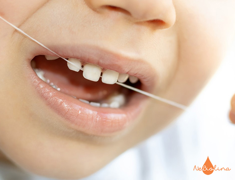 Thực hiện nhổ răng bằng chỉ nha khoa đơn giản