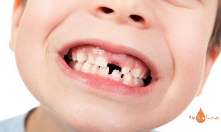 Tốc độ mọc răng vĩnh viễn phụ thuộc vào nhiều yếu tố