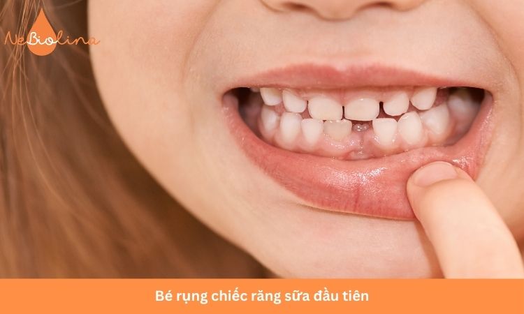 Bé gái thường thay răng sớm hơn bé trai.