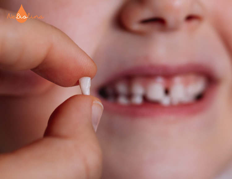 Nhổ răng bằng ngón tay quấn gạc vô trùng là cách được khuyên dùng