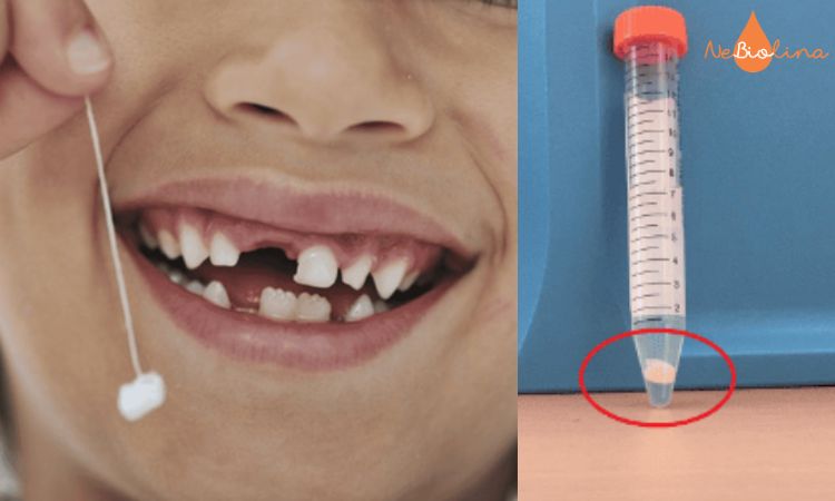 Răng sữa chứa tế bào gốc có giá trị, nhiều bố mẹ lựa chọn lưu trữ thay vì vứt bỏ.