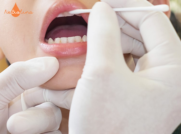 Bôi Vecni Fluor cải thiện tình trạng sâu răng nhẹ của trẻ