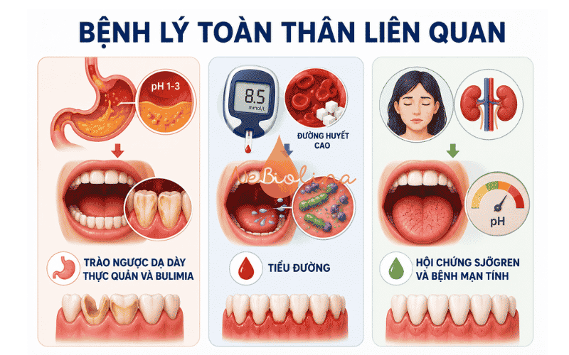 Trào ngược dạ dày, tiểu đường là nguyên nhân của bệnh sâu răng