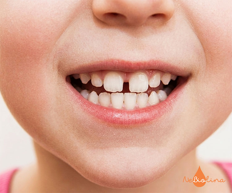 Trẻ sẽ có đủ 20 chiếc răng sữa khi được từ 2,5 đến 3 tuổi