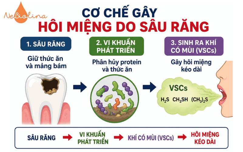 Cơ chế gây hôi miệng do sâu răng