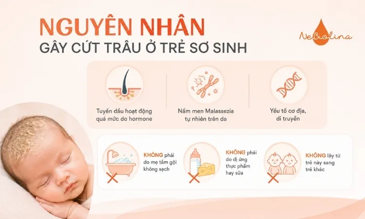 Nguyên nhân chính gây cứt trâu ở trẻ sơ sinh