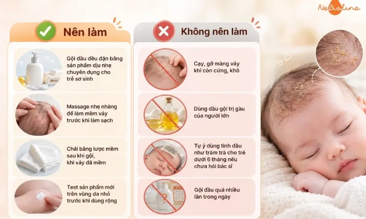 Những điều nên và không nên làm