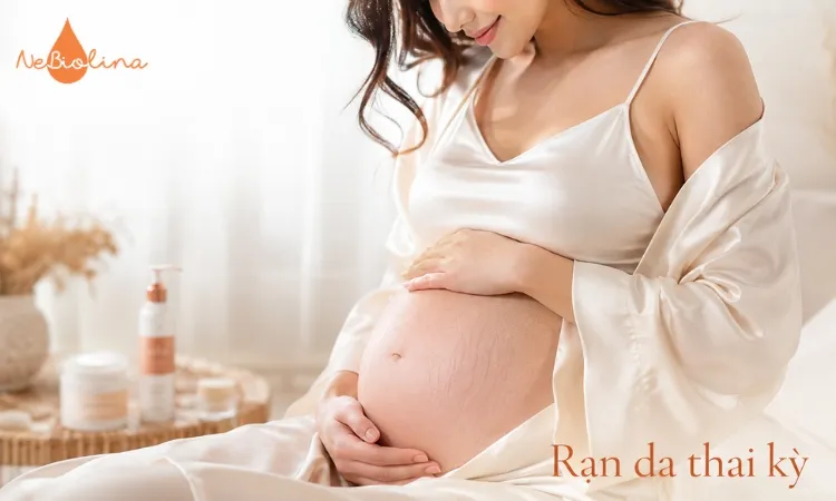 80 - 90% phụ nữ bị rạn da trong thai kỳ