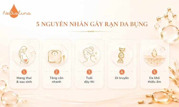 Các nguyên nhân phổ biến gây rạn da bụng