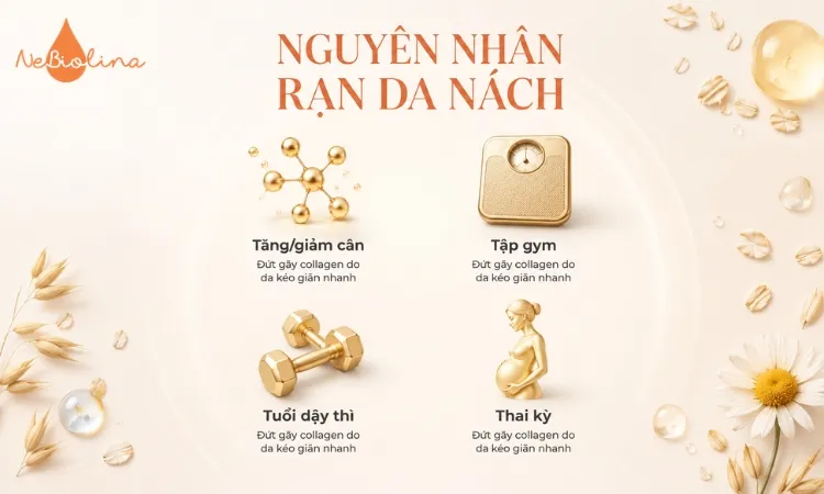 Rạn da nách có thể do nhiều nguyên nhân khác nhau