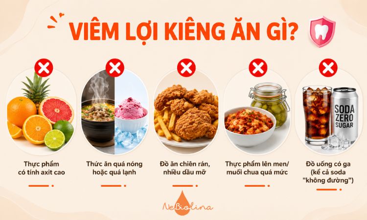Một số thực phẩm cần kiêng khi bị viêm lợi