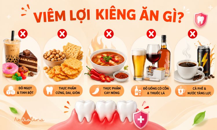Một số thực phẩm cần kiêng khi bị viêm lợi