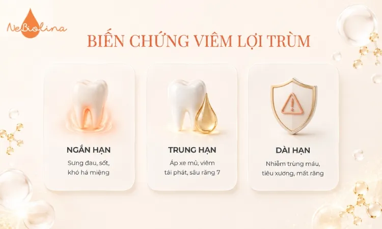Viêm lợi trùm không điều trị kịp thời dẫn đến nhiều biến chứng nguy hiểm.