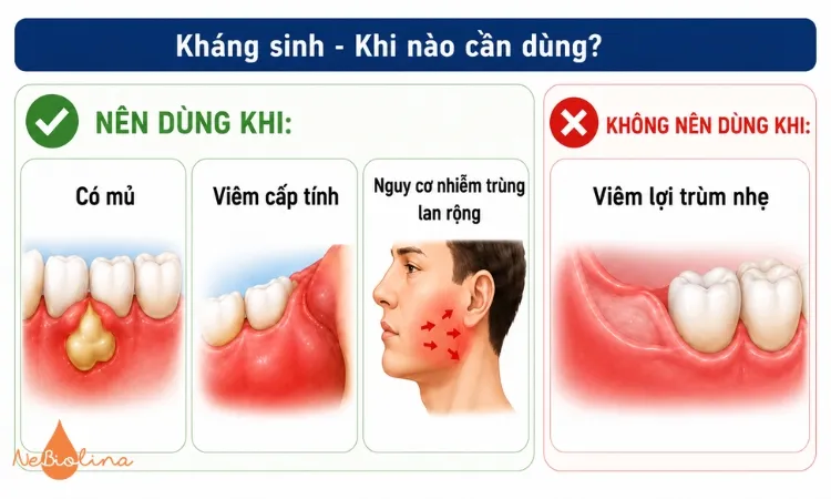 Những điều cần nhớ khi dùng thuốc kháng sinh trị viêm lợi trùm.