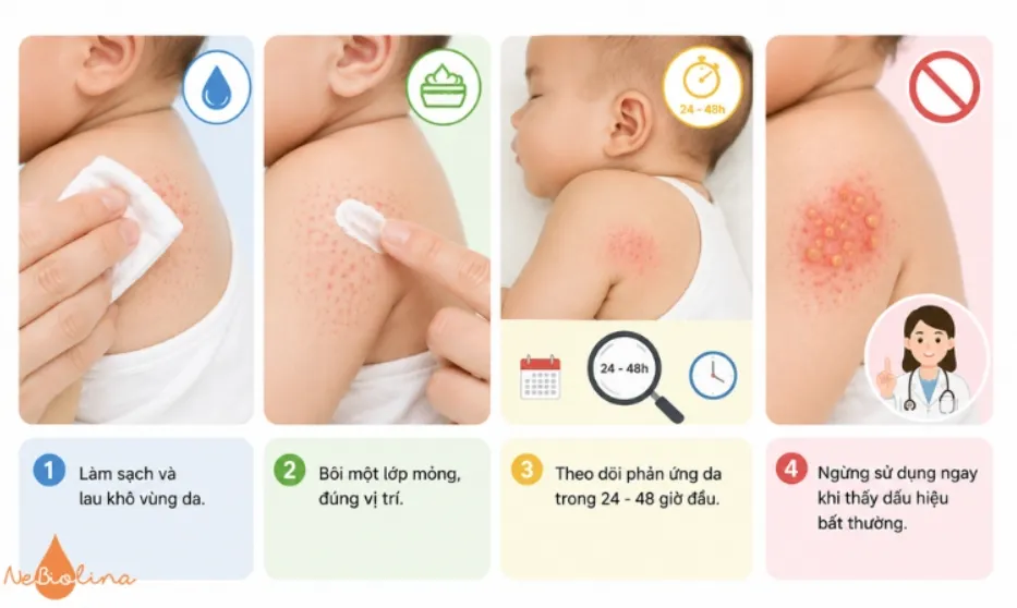Bôi thuốc đúng cách để tăng hiệu quả điều trị rôm sảy cho bé.