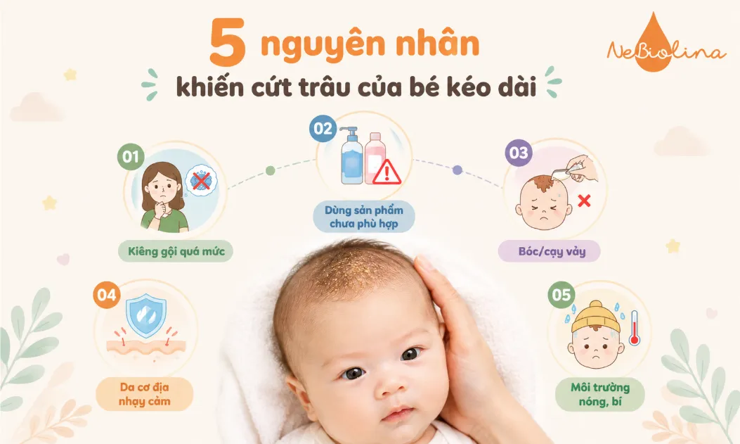 Những nguyên nhân chính khiến cứt trâu ở trẻ kéo dài