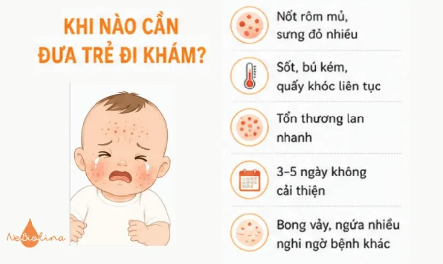 Dấu hiệu cần đưa trẻ đi khám.