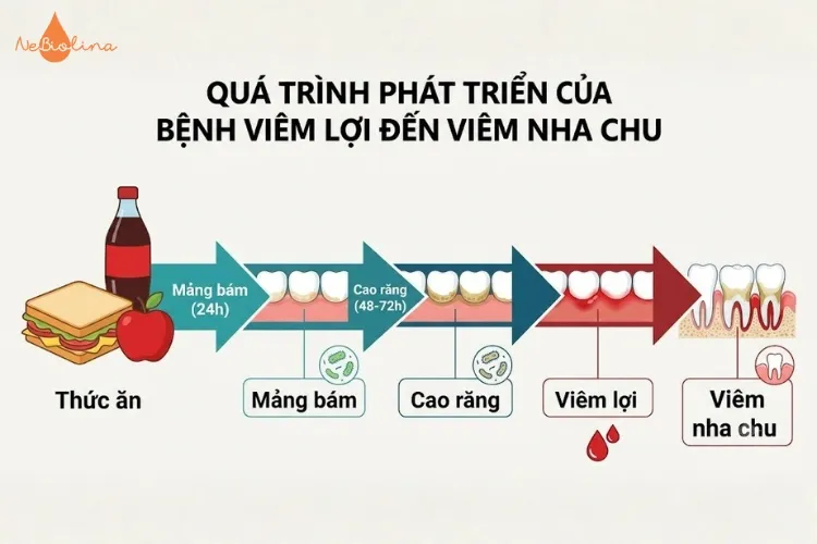 Quá trình phát triển của viêm lợi