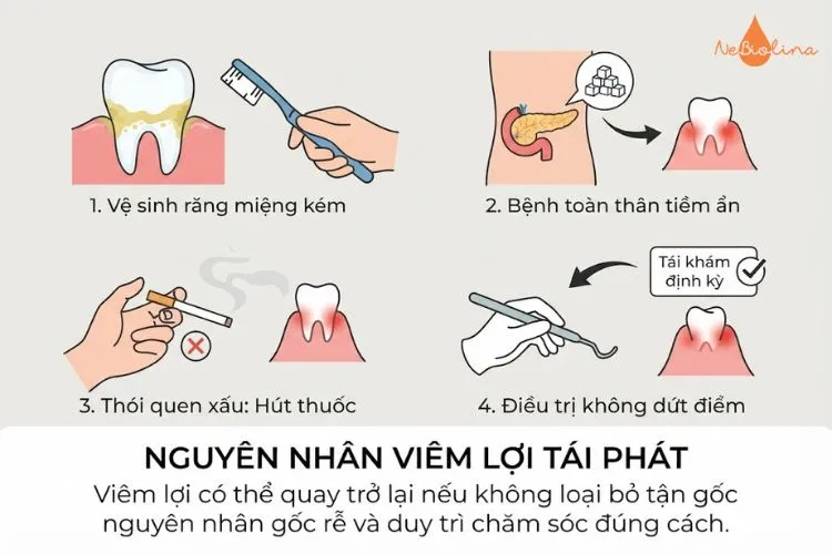 Nguyên nhân viêm lợi tái phát lại