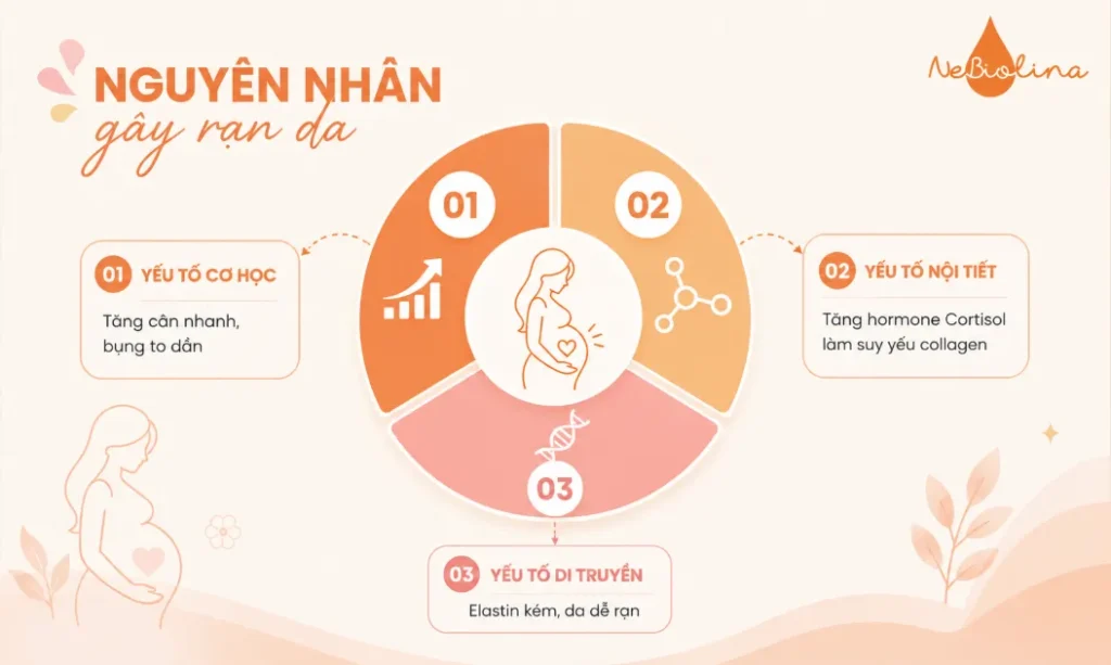 Những nguyên nhân chủ yếu gây rạn da