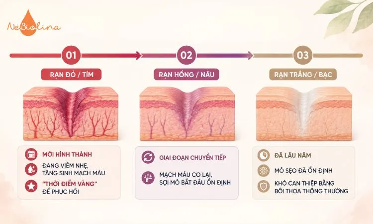 3 giai đoạn đổi màu vết rạn da sau sinh