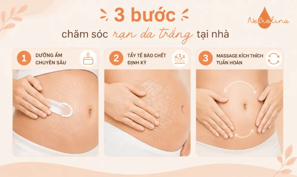 3 bước chăm sóc rạn da trắng tại nhà