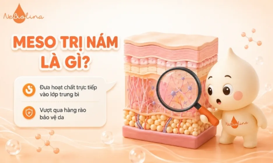 Meso trị nám là kỹ thuật đưa hoạt chất trực tiếp vào lớp trung bì hoặc hạ bì