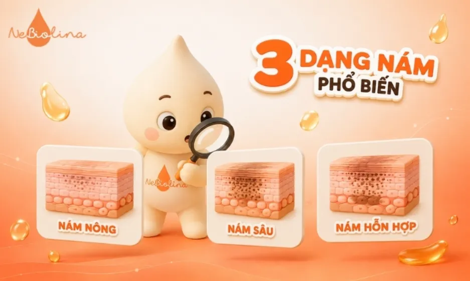 Phân biệt dạng nám trước khi bắt đầu điều trị