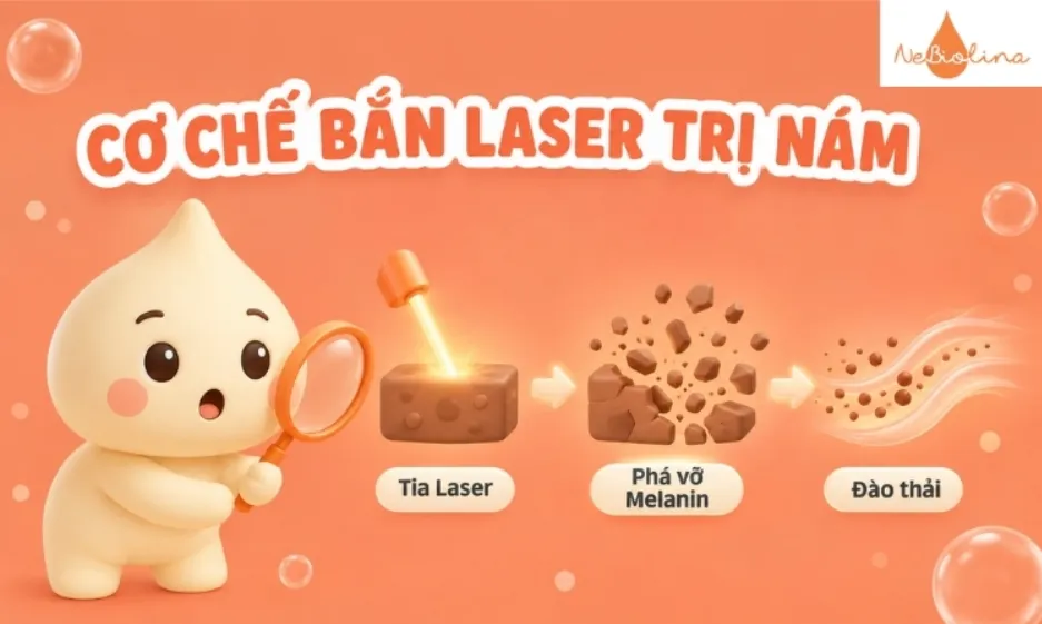 Cơ chế bắn laser là sử dụng xung năng lượng tác động chọn lọc lên melanin