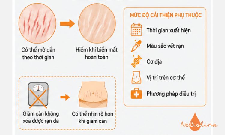Rạn da do tăng cân có hết không?