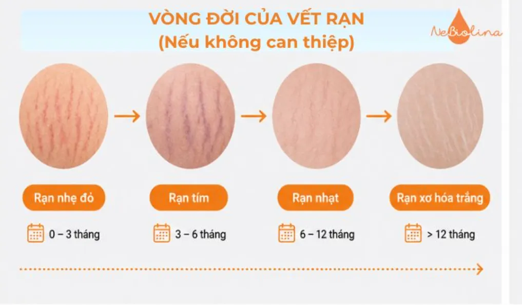 Quá trình hình thành rạn da. 