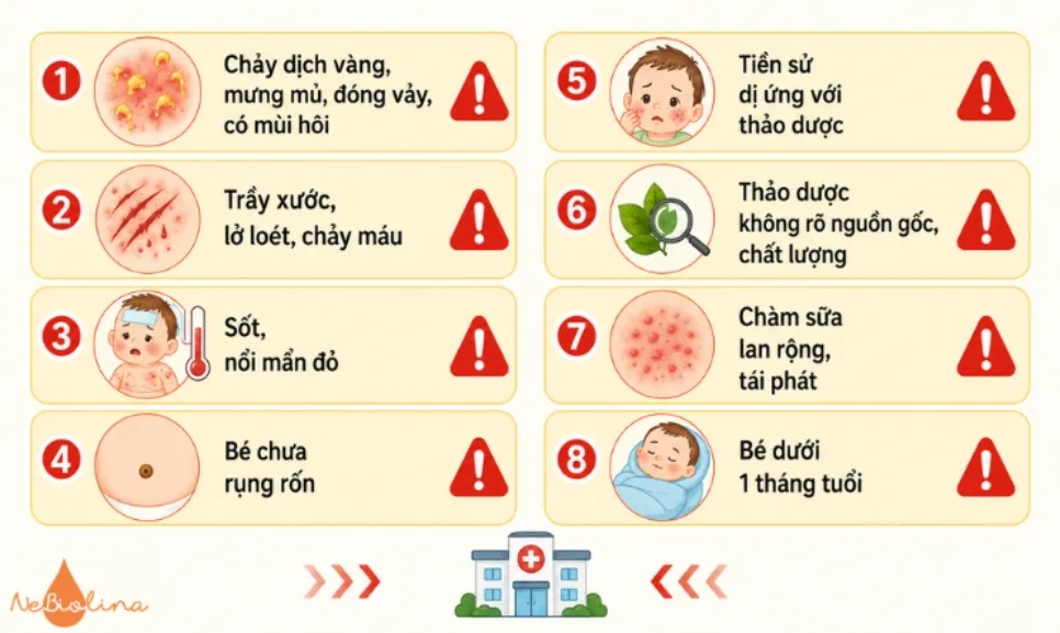 Cha mẹ không tự chữa tại nhà mà đưa bé đi khám ngay khi có một trong những dấu hiệu trên.