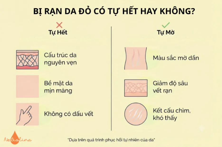 Bị rạn da đỏ có tự hết hay không?