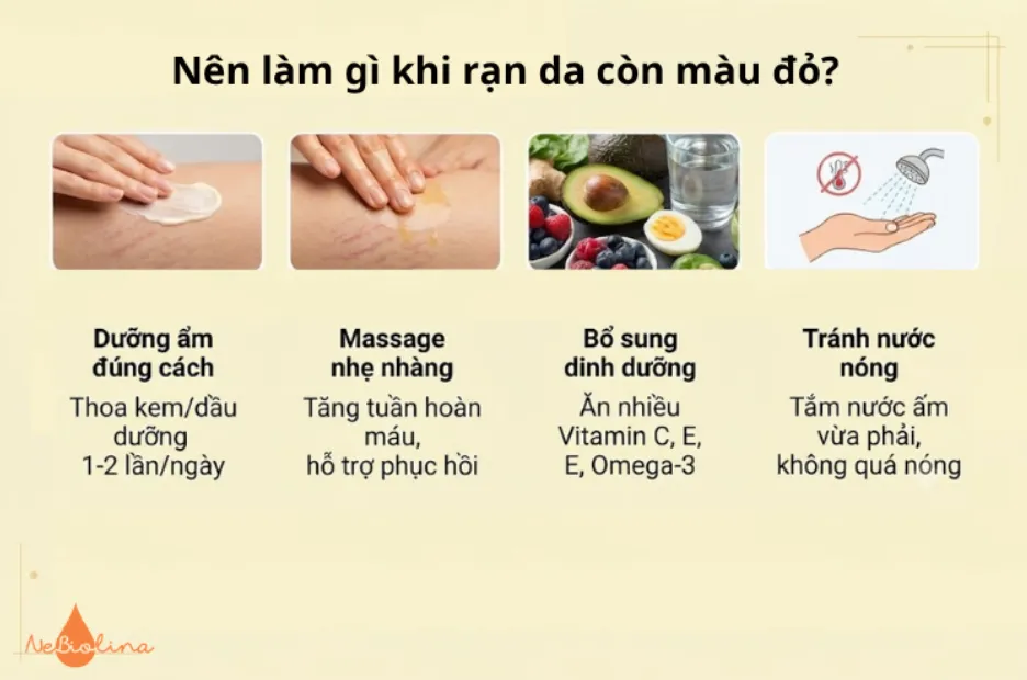 Nên làm gì khi rạn da còn màu đỏ?