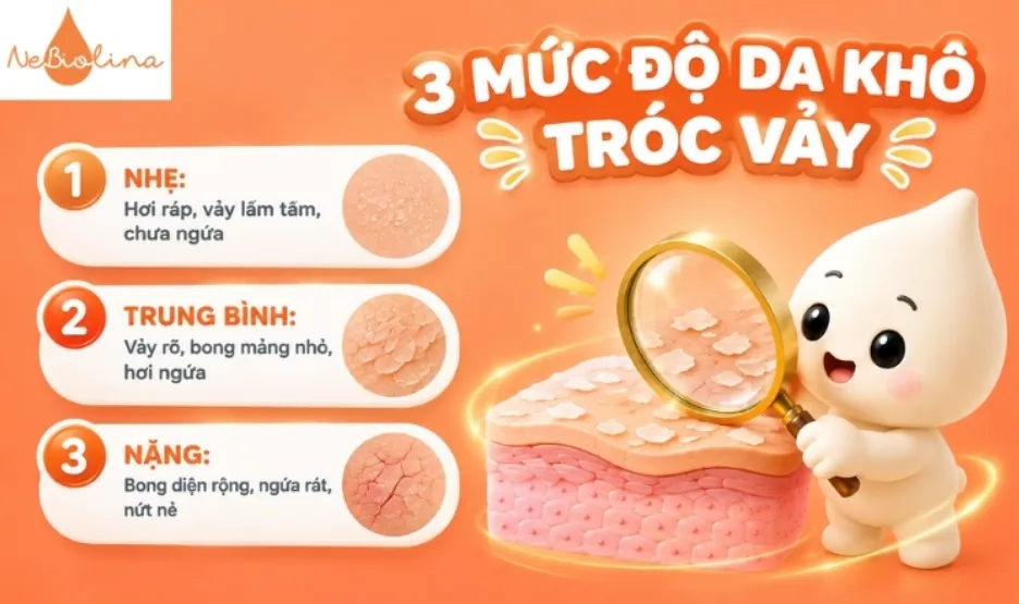 3 mức độ da cánh tay bị khô tróc vảy