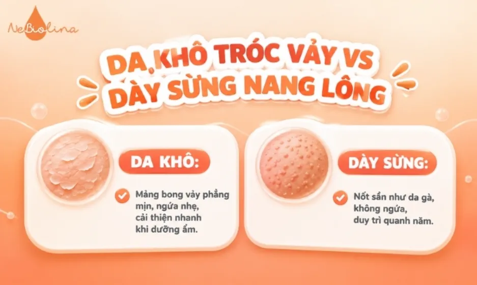 Phân biệt da khô tróc vảy và dày sừng nang lông
