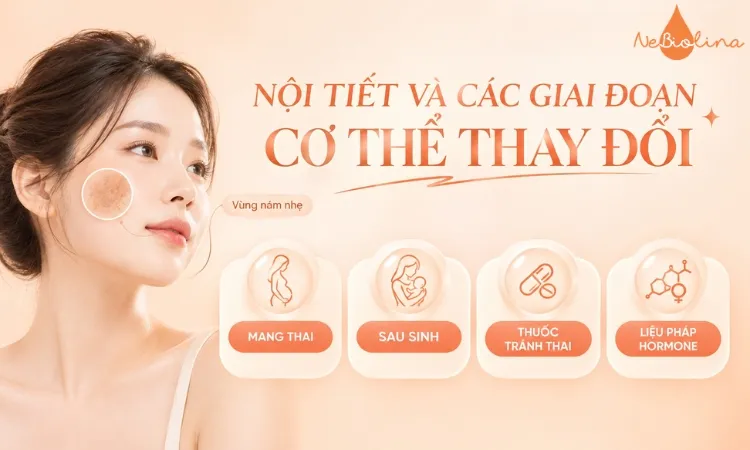 Sự thay đổi của nội tiết tố có thể là nguyên nhân gây nám da