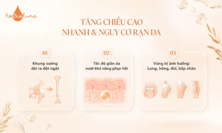Tăng chiều cao nhanh có thể gây rạn da dù không tăng cân
