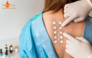 Phương pháp Patch test trong thử nghiệm lâm sàng trên da