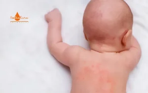 ảnh đại diện chàm sữa