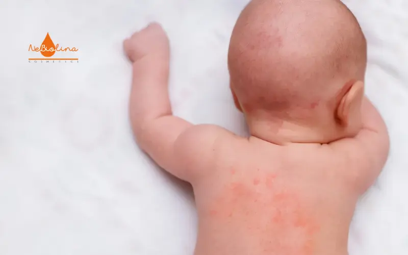 ảnh đại diện chàm sữa