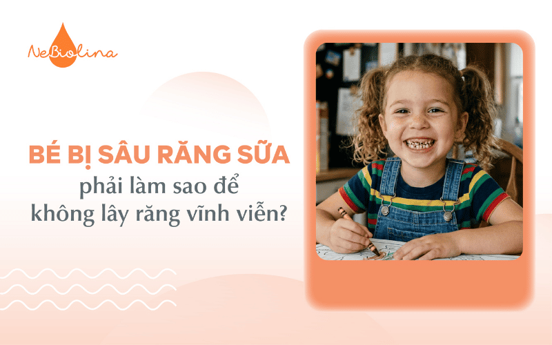 Bé bị sâu răng sữa