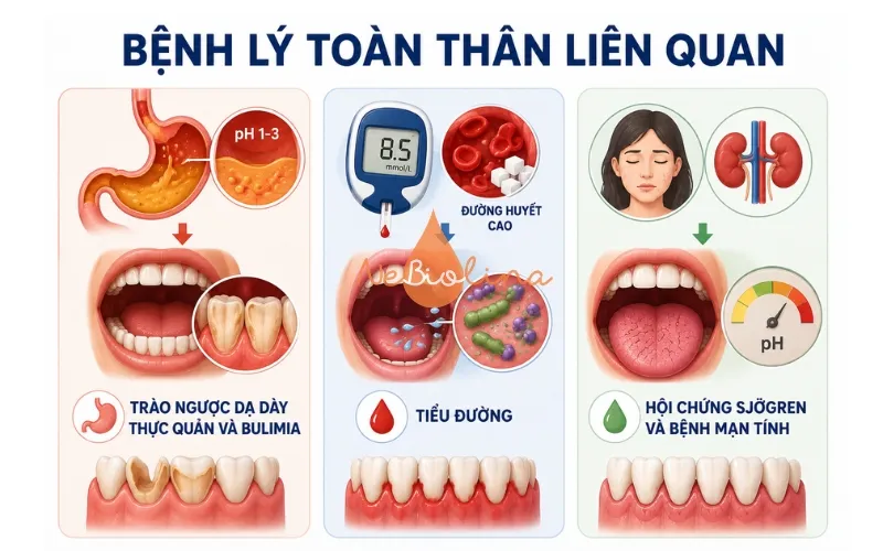 Trào ngược dạ dày, tiểu đường là nguyên nhân của bệnh sâu răng