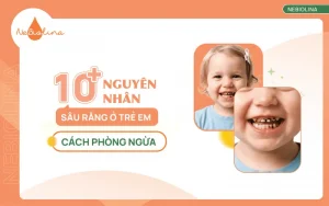 Nguyên nhân sâu răng ở trẻ em