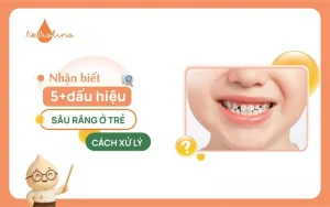 Nhận biết 5+dấu hiệu sâu răng ở trẻ và cách xử lý