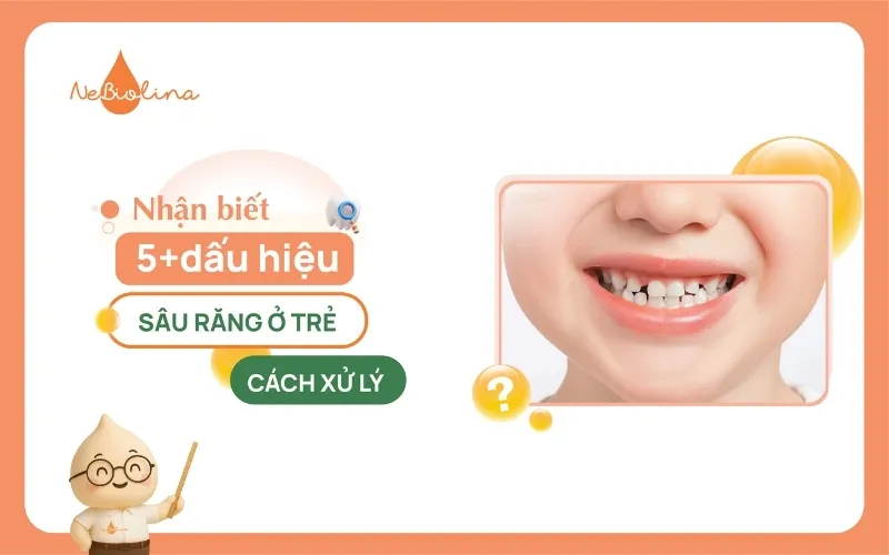 Nhận biết 5+dấu hiệu sâu răng ở trẻ và cách xử lý