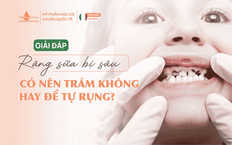 ảnh Răng sữa bị sâu có nên trám không hay để tự rụng (1)