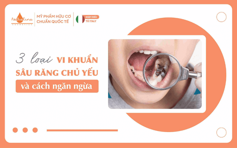3 loại vi khuẩn sâu răng chủ yếu và cách ngăn ngừa. 